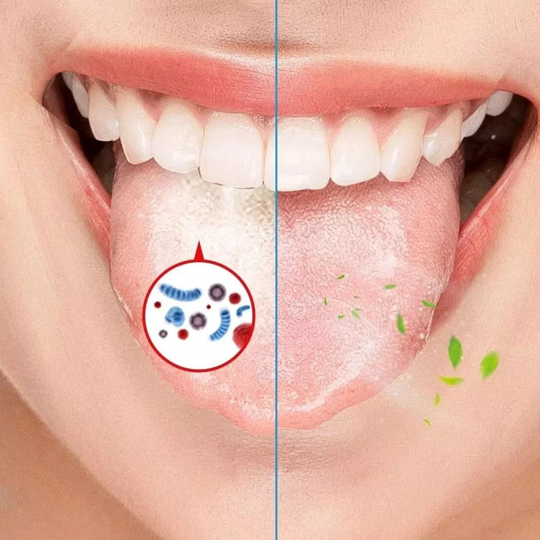 Limpiador de Lengua en Estuche